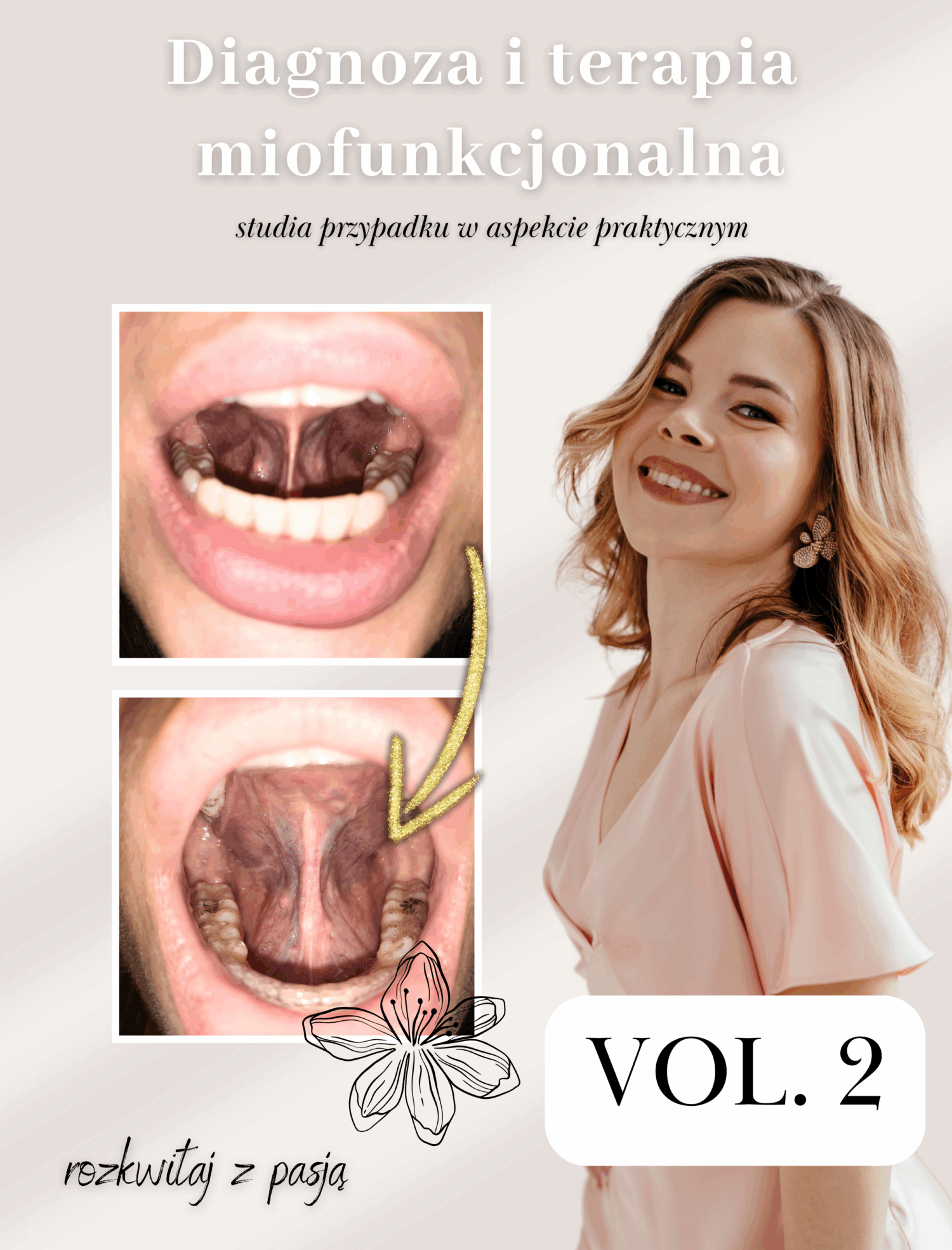 vol2 KURS WIDEO: Diagnoza i terapia miofunkcjonalna – studia przypadku w aspekcie praktycznym VOL.2