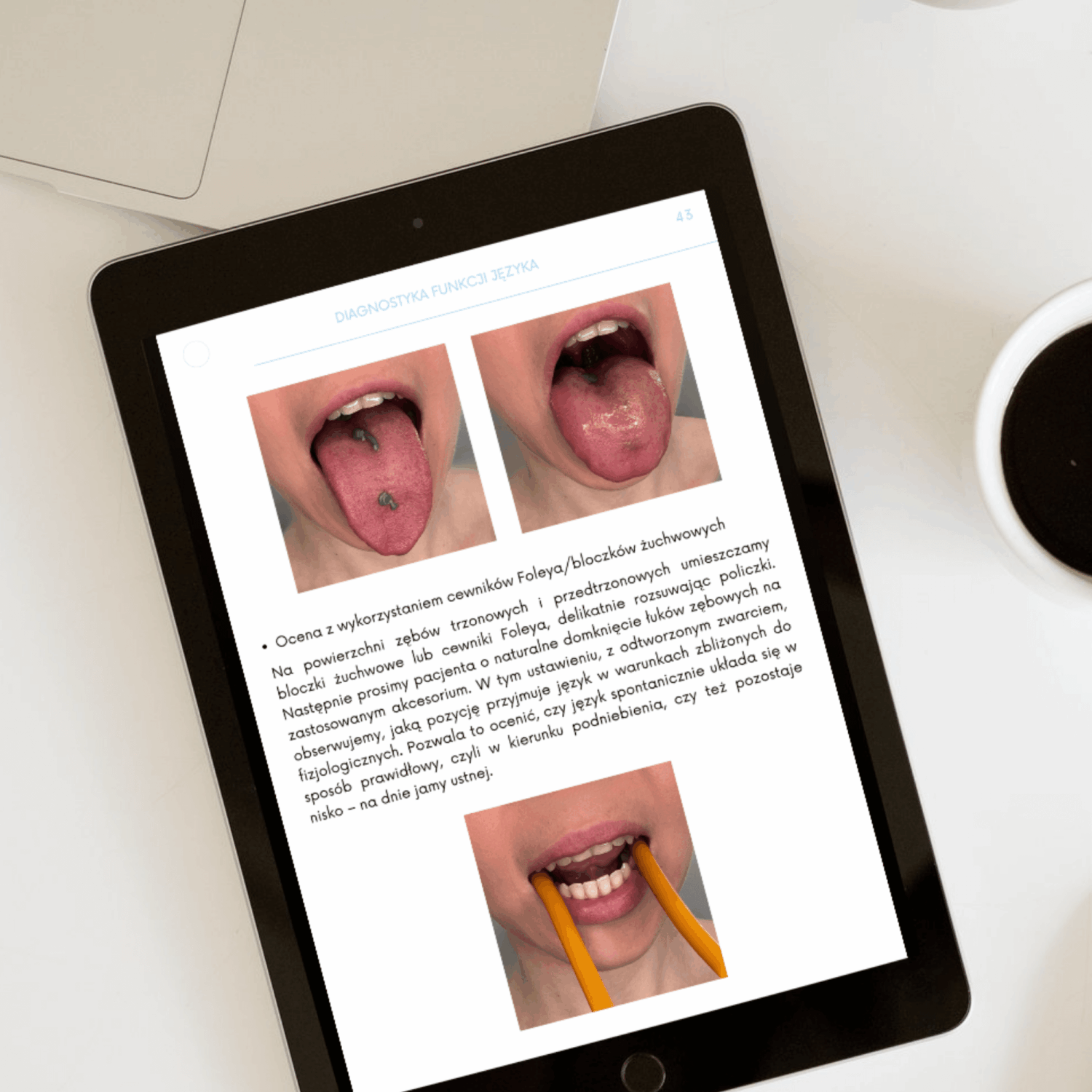 Mioencyklopedia 2: Rehabilitacja dysfunkcji języka